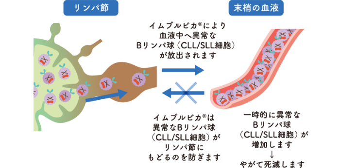 イムブルビカ®による一時的なリンパ球の増加