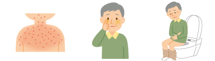 急性GVHDの症状