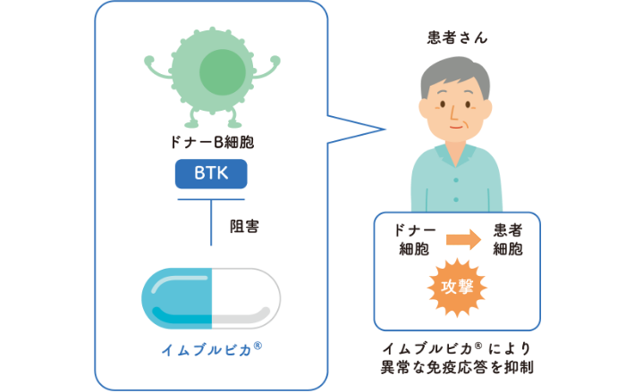 慢性GVHD
