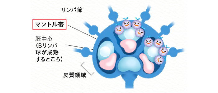 マントル細胞リンパ腫の今後の見通しはどうなりますか?
